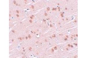 Immunohistochemistry (IHC) image for anti-Synaptogyrin 1 (SYNGR1) (Middle Region) antibody (ABIN1031113) (Synaptogyrin 1 Antikörper  (Middle Region))