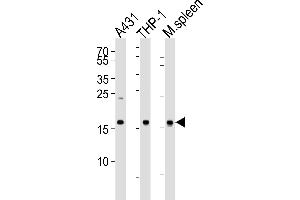 Western blot analysis of lysates from A431, THP-1 cell line and mouse spleen tissue lysate (from left to right), using SNX3 Antibody at 1:1000 at each lane.