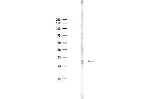 Western blot analysis of lysates from Rat brain, using C Antibody at 1/1000 dilution.