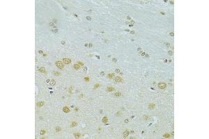 Immunohistochemistry of paraffin-embedded rat brain using RSRC1 antibody (ABIN5974341) at dilution of 1/100 (40x lens). (RSRC1 Antikörper)