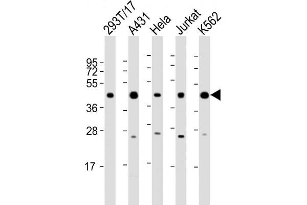 PHF6 antibody  (AA 315-349)