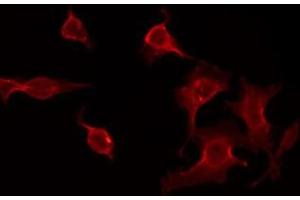 ABIN6275677 staining HepG2 by IF/ICC. (CACNG7 Antikörper  (Internal Region))