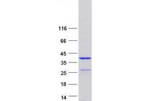 SYCE1L Protein (Myc-DYKDDDDK Tag)