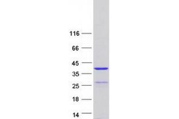 SYCE1L Protein (Myc-DYKDDDDK Tag)