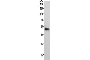 Western Blotting (WB) image for anti-Midnolin (MIDN) antibody (ABIN2426213) (MIDN Antikörper)