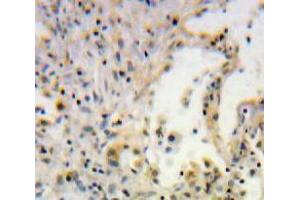 IHC-P analysis of Lung tissue, with DAB staining. (SCGB1A1 Antikörper  (AA 21-96))