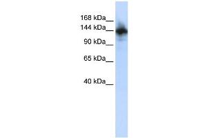 WB Suggested Anti-RBM6 Antibody Titration: 0. (RBM6 Antikörper  (N-Term))