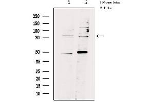Western blot analysis of extracts from various samples, using FSHR Antibody. (FSHR Antikörper  (Internal Region))