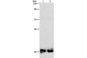 Western Blot analysis of Mouse kidney and Human fetal kidney tissue using ASPA Polyclonal Antibody at dilution of 1:1400 (ASPA Antikörper)