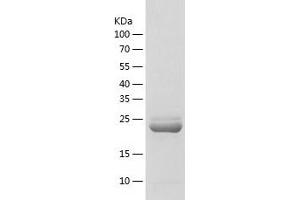 AK4 Protein (AA 1-223) (His tag)