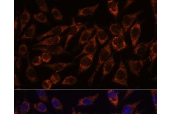 PYCR2 anticorps