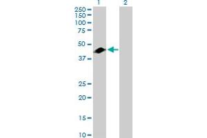Western Blot analysis of GART expression in transfected 293T cell line by GART MaxPab rabbit polyclonal antibody. (GART Antikörper  (AA 1-433))