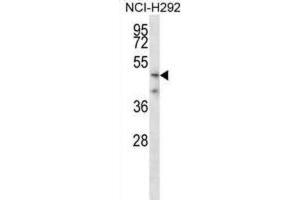 Western Blotting (WB) image for anti-Transmembrane Protease, serine 5 (TMPRSS5) antibody (ABIN2998262) (TMPRSS5 Antikörper)