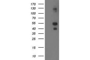 Western Blotting (WB) image for anti-LIM and Cysteine-Rich Domains 1 (LMCD1) antibody (ABIN1499184) (LMCD1 Antikörper)