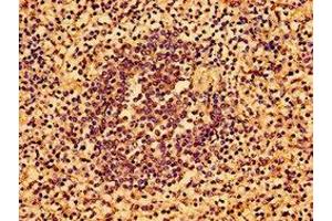 Immunohistochemistry of paraffin-embedded human spleen tissue using ABIN7143732 at dilution of 1:100 (AAGAB Antikörper  (AA 191-315))