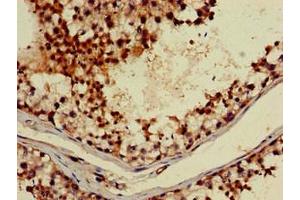 Immunohistochemistry of paraffin-embedded human testis tissue using ABIN7142928 at dilution of 1:100 (ABI2 Antikörper  (AA 164-452))