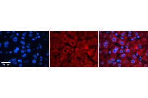 Rabbit Anti-TFB1M Antibody    Formalin Fixed Paraffin Embedded Tissue: Human Adult liver  Observed Staining: Cytoplasmic Primary Antibody Concentration: 1:100 Secondary Antibody: Donkey anti-Rabbit-Cy2/3 Secondary Antibody Concentration: 1:200 Magnification: 20X Exposure Time: 0.
