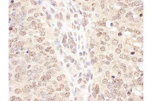 Immunohistochemistry (IHC) image for anti-Transcription Elongation Factor B (SIII), Polypeptide 2 (18kDa, Elongin B) (TCEB2) (AA 68-118) antibody (ABIN7453458)