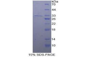 SDS-PAGE (SDS) image for Cadherin-16 (CDH16) (AA 37-287) protein (His tag) (ABIN2124197)