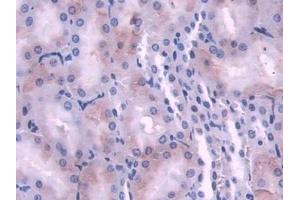 DAB staining on IHC-P; Samples: Rat Kidney Tissue (NDRG2 Antikörper  (AA 2-300))
