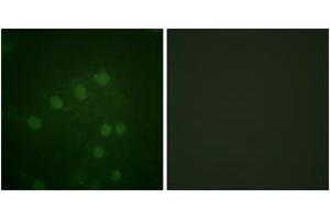 Immunofluorescence analysis of HepG2 cells, using AurB (Phospho-Thr232) Antibody. (Aurora Kinase B Antikörper  (pThr232))