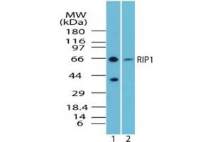 Image no. 1 for anti-Receptor (TNFRSF)-Interacting serine-threonine Kinase 1 (RIPK1) (AA 350-400) antibody (ABIN207743) (RIPK1 Antikörper  (AA 350-400))