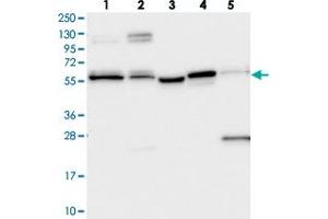 Western blot analysis of Lane 1: RT-4, Lane 2: U-251 MG, Lane 3: Human Plasma, Lane 4: Liver, Lane 5: Tonsil with PPRC1 polyclonal antibody  at 1:250-1:500 dilution. (PPRC1 Antikörper)