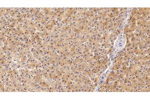Immunohistochemistry (IHC) image for anti-Insulin-Like Growth Factor 1 (IGF1) (AA 49-118) antibody (ABIN7442501)