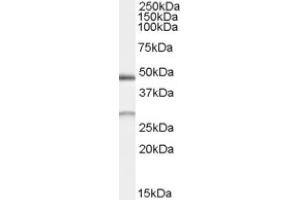 Image no. 1 for anti-BCL2/adenovirus E1B 19kDa Interacting Protein 1 (BNIP1) (Internal Region), (Isoform 1) antibody (ABIN375177) (BNIP1 Antikörper  (Internal Region, Isoform 1))