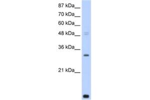 Western Blotting (WB) image for anti-CCR4-NOT Transcription Complex, Subunit 7 (CNOT7) antibody (ABIN2461842) (CNOT7 Antikörper)