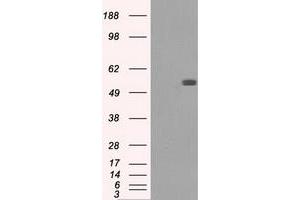 HEK293T cells were transfected with the pCMV6-ENTRY control (Left lane) or pCMV6-ENTRY FH (Right lane) cDNA for 48 hrs and lysed. (FH Antikörper)