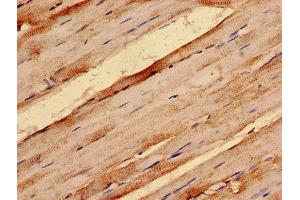 IHC analysis of paraffin-embedded human skeletal muscle tissue, using G0S2 antibody (1/100 dilution). (G0S2 Antikörper  (AA 1-103))