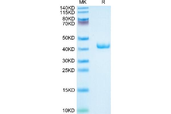 APOA2 Protein (AA 19-102) (Fc Tag)