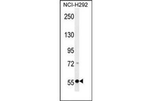Western Blotting (WB) image for anti-Excision Repair Cross-Complementing Rodent Repair Deficiency, Complementation Group 6-Like 2 (ERCC6L2) (AA 233-263), (Middle Region) antibody (ABIN954432)