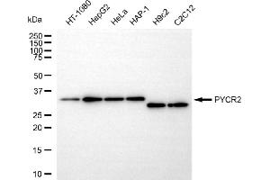 Western blotting analysis using PYCR2 antibody (ABIN7800079). (PYCR2 Antikörper)