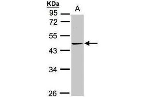 WB Image Sample(30 ug whole cell lysate) A:Hep G2 , 10% SDS PAGE antibody diluted at 1:1000 (PRMT2 Antikörper)