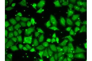 Immunofluorescence analysis of U2OS cells using MLST8 antibody (ABIN6131371, ABIN6143894, ABIN6143895 and ABIN6217660). (GBL Antikörper  (AA 1-326))