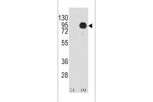 Western Blotting (WB) image for anti-Small Nuclear Ribonucleoprotein Polypeptide E (SNRPE) (AA 424-453) antibody (ABIN392249)