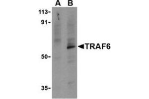 Western blot analysis of TRAF6 in PC-3 cell lysates with this product at 1 μg/ml in the presence (A) or absence (B) of 1 μg blocking peptide. (TRAF6 Antikörper  (C-Term))