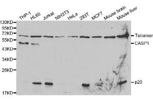Western blot analysis of extracts of various cell lines, using CASP1 antibody. (Caspase 1 Antikörper  (AA 1-311))
