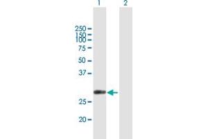 Western Blot analysis of CUTC expression in transfected 293T cell line by CUTC MaxPab polyclonal antibody.