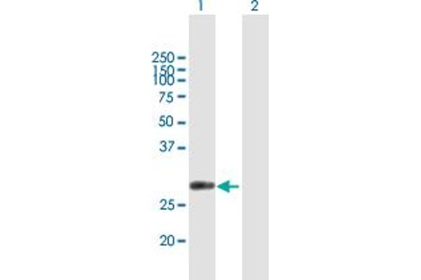 CUTC anticorps  (AA 1-273)