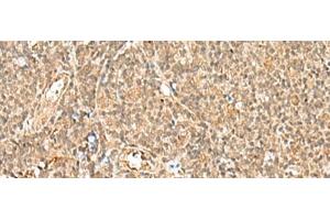 Immunohistochemistry of paraffin-embedded Human tonsil tissue using GTF2A2 Polyclonal Antibody at dilution of 1:30(x200)
