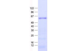 ZNF582 Protein (His tag)