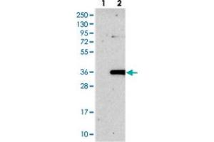 Western blot analysis of Lane 1: Negative control (vector only transfected HEK293T lysate), Lane 2: Over-expression Lysate (Co-expressed with a C-terminal myc-DDK tag (~3. (ROGDI Antikörper)