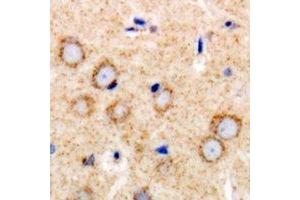 Immunohistochemical analysis of TGFBR2 staining in human brain formalin fixed paraffin embedded tissue section. (TGFBR2 Antikörper)