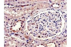 Immunohistochemistry of paraffin-embedded human kidney tissue using ABIN7156864 at dilution of 1:100 (IL23R Antikörper  (AA 15-125))