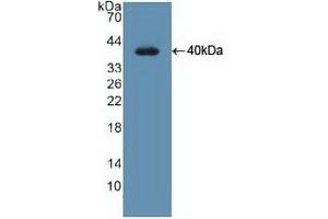 Detection of Recombinant UNG, Human using Polyclonal Antibody to Uracil DNA Glycosylase (UNG) (UNG Antikörper  (AA 1-313))