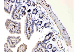 IHC analysis of Bax using anti-Bax antibody . (BAX Antikörper  (N-Term))