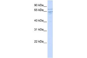 WB Suggested Anti-EDEM1 Antibody Titration:  0. (EDEM1 Antikörper  (N-Term))